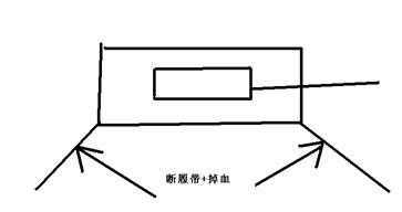 给新手们的技术贴：关于断履带及其应用